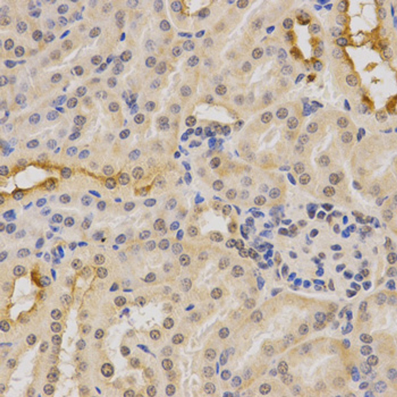 Immunohistochemistry of paraffin-embedded mouse kidney using PDHA1 Antibody (15-043) at dilution of 1:200 (40x lens) .