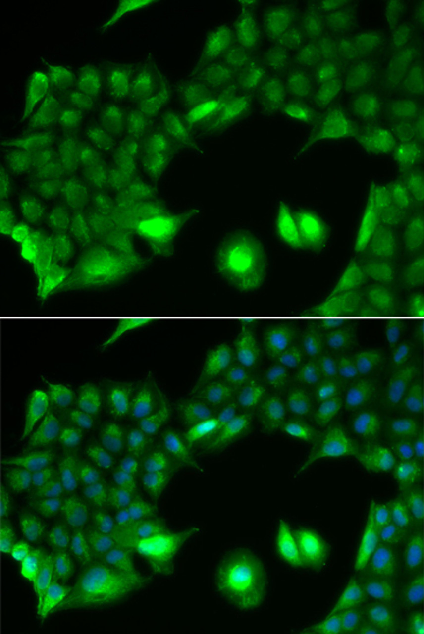 Immunofluorescence analysis of HeLa cells using SSX2 antibody (15-061) . Blue: DAPI for nuclear staining.