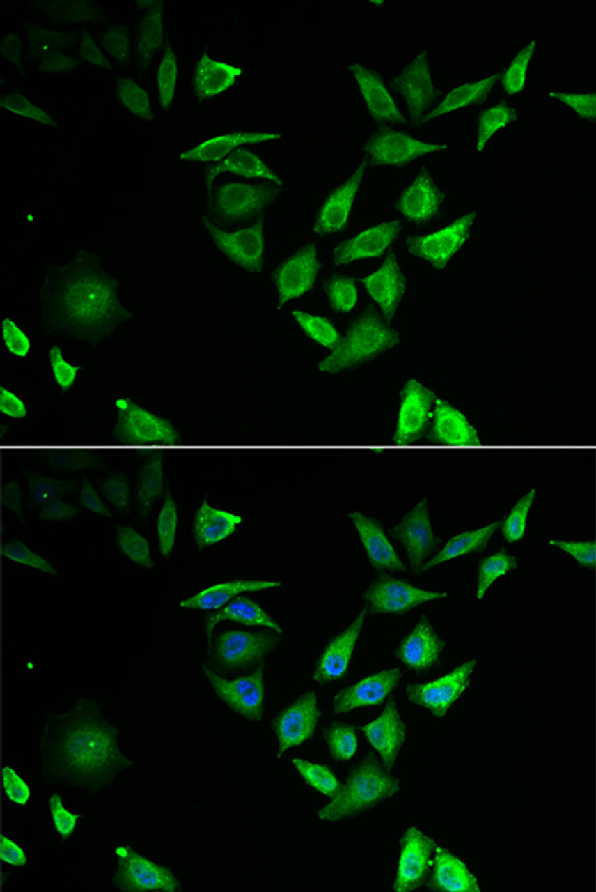 Immunofluorescence analysis of U2OS cells using NUTF2 antibody (15-080) . Blue: DAPI for nuclear staining.