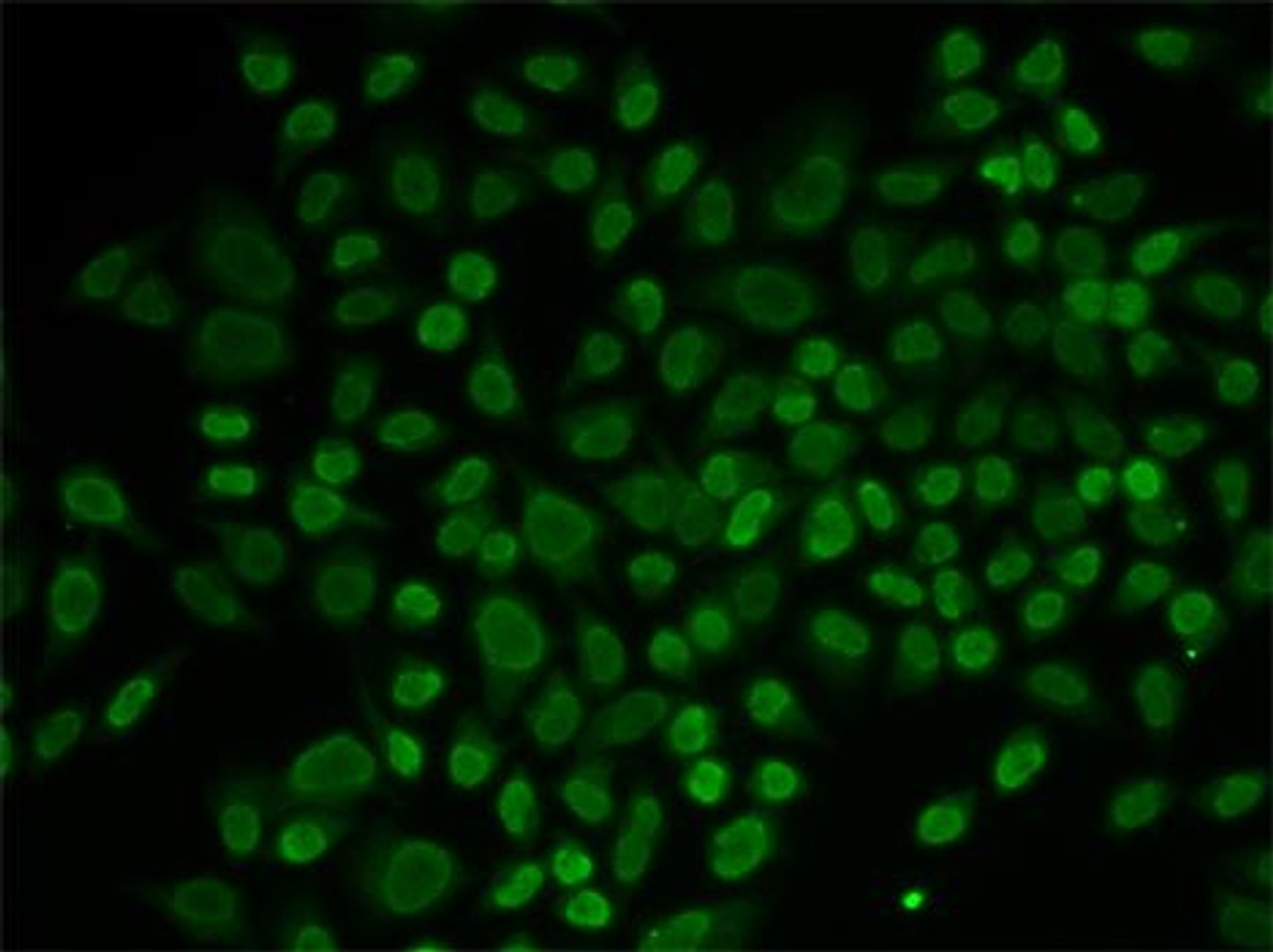 Immunofluorescence analysis of MCF-7 cells using RAD54L2 antibody (15-088) . Blue: DAPI for nuclear staining.