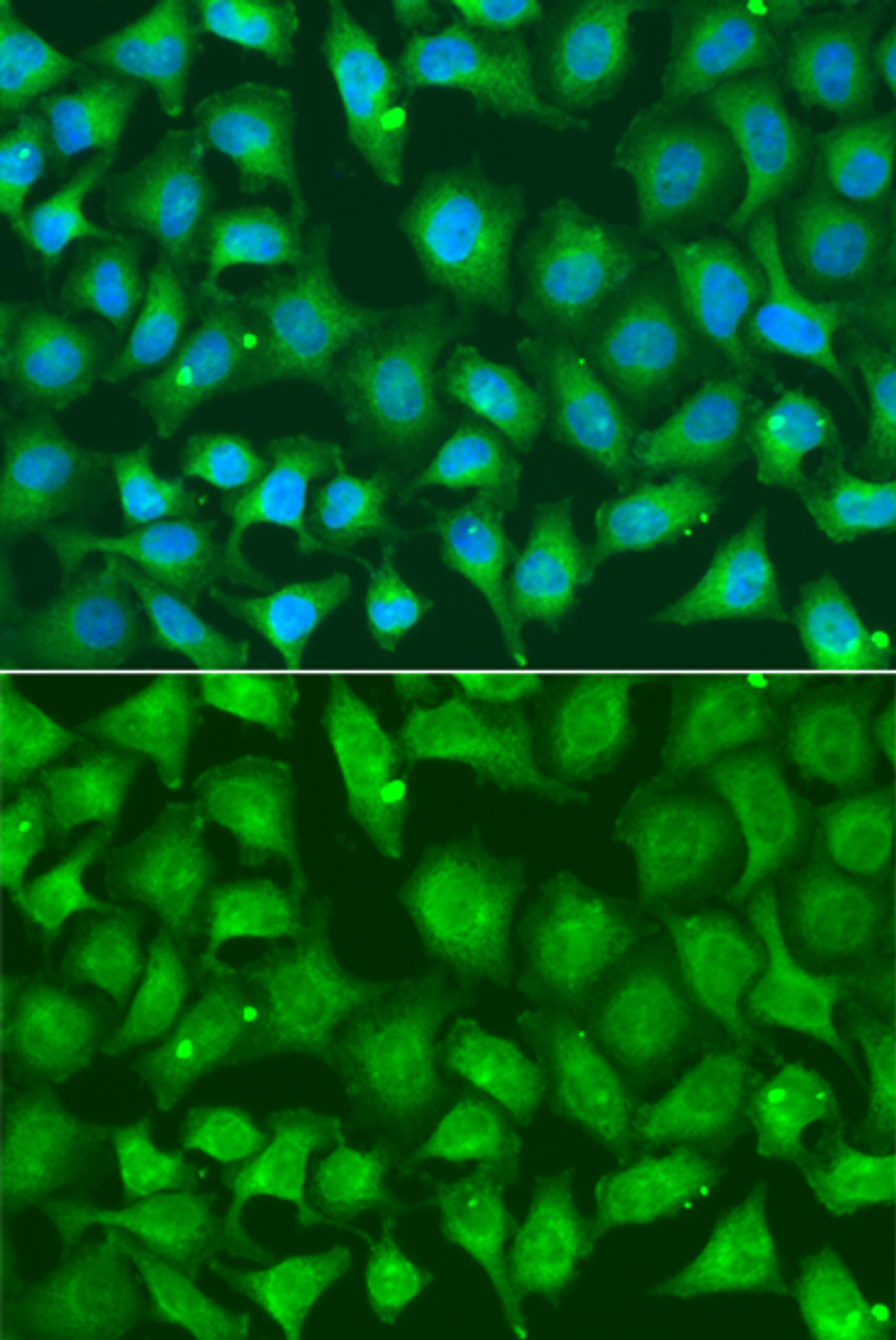 Immunofluorescence analysis of A549 cells using XRCC2 antibody (15-120) . Blue: DAPI for nuclear staining.
