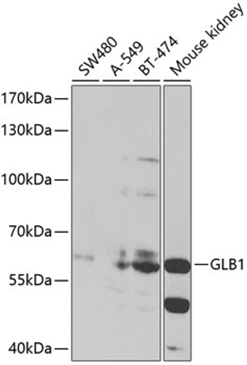 Western blot analysis of extracts of various cell lines, using GLB1 antibody (15-136) at 1:1000 dilution.<br/>Secondary antibody: HRP Goat Anti-Rabbit IgG (H+L) at 1:10000 dilution.<br/>Lysates/proteins: 25ug per lane.<br/>Blocking buffer: 3% nonfat dry milk in TBST.