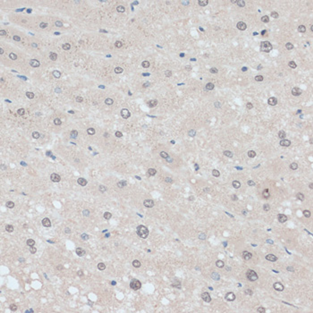 Immunohistochemistry of paraffin-embedded human liver using ZNF707 antibody (15-174) at dilution of 1:100 (40x lens) .