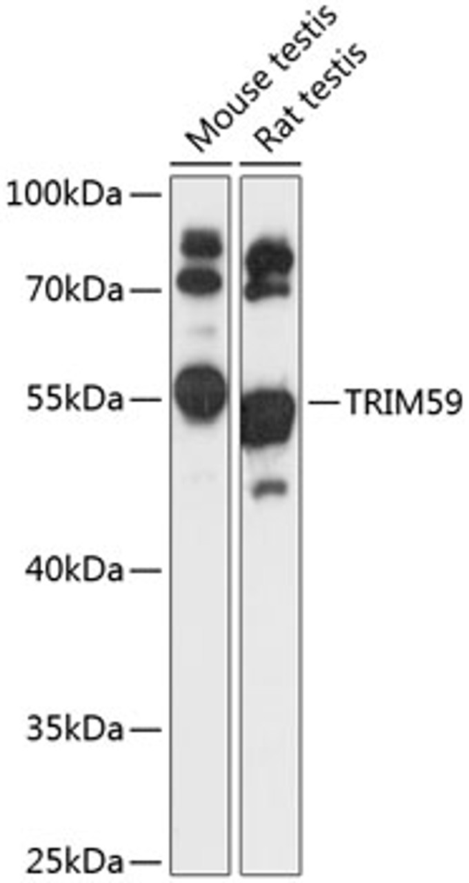 Western blot analysis of extracts of various cell lines, using TRIM59 antibody (15-246) at 1:1000 dilution.<br/>Secondary antibody: HRP Goat Anti-Rabbit IgG (H+L) at 1:10000 dilution.<br/>Lysates/proteins: 25ug per lane.<br/>Blocking buffer: 3% nonfat dry milk in TBST.<br/>Detection: ECL Basic Kit.<br/>Exposure time: 90s.