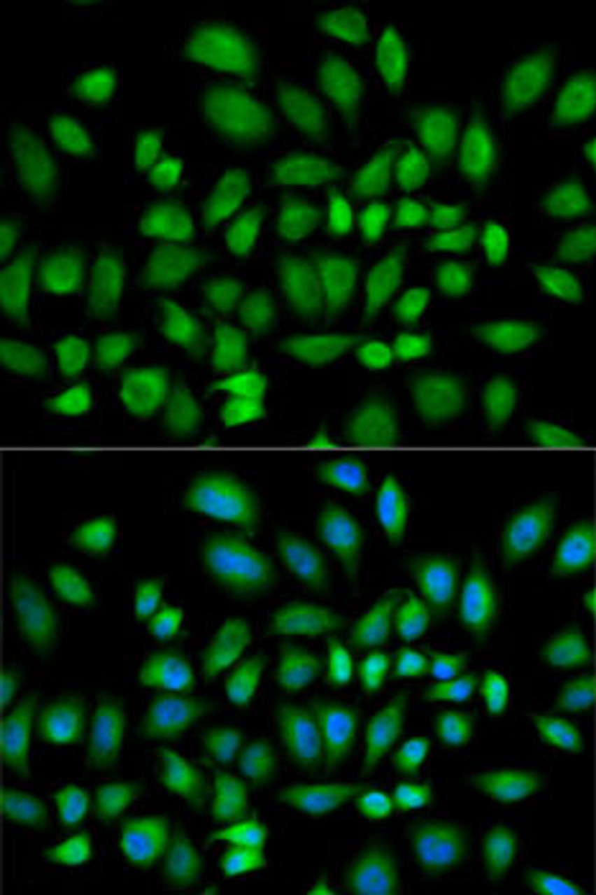 Immunofluorescence analysis of HeLa cells using PDE4D antibody (15-277) . Blue: DAPI for nuclear staining.