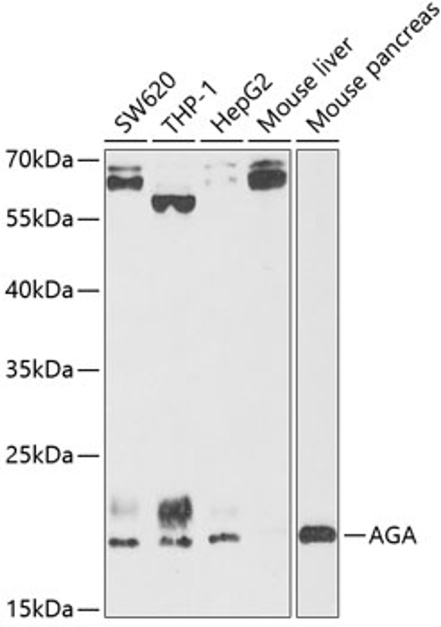 Western blot analysis of extracts of various cell lines, using AGA antibody (15-281) at 1:1000 dilution.<br/>Secondary antibody: HRP Goat Anti-Rabbit IgG (H+L) at 1:10000 dilution.<br/>Lysates/proteins: 25ug per lane.<br/>Blocking buffer: 3% nonfat dry milk in TBST.<br/>Detection: ECL Basic Kit.<br/>Exposure time: 90s.