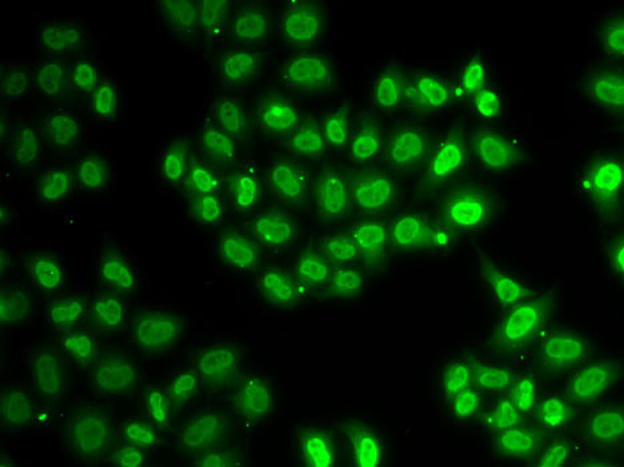 Immunofluorescence analysis of U2OS cells using EWSR1 antibody (15-303) .