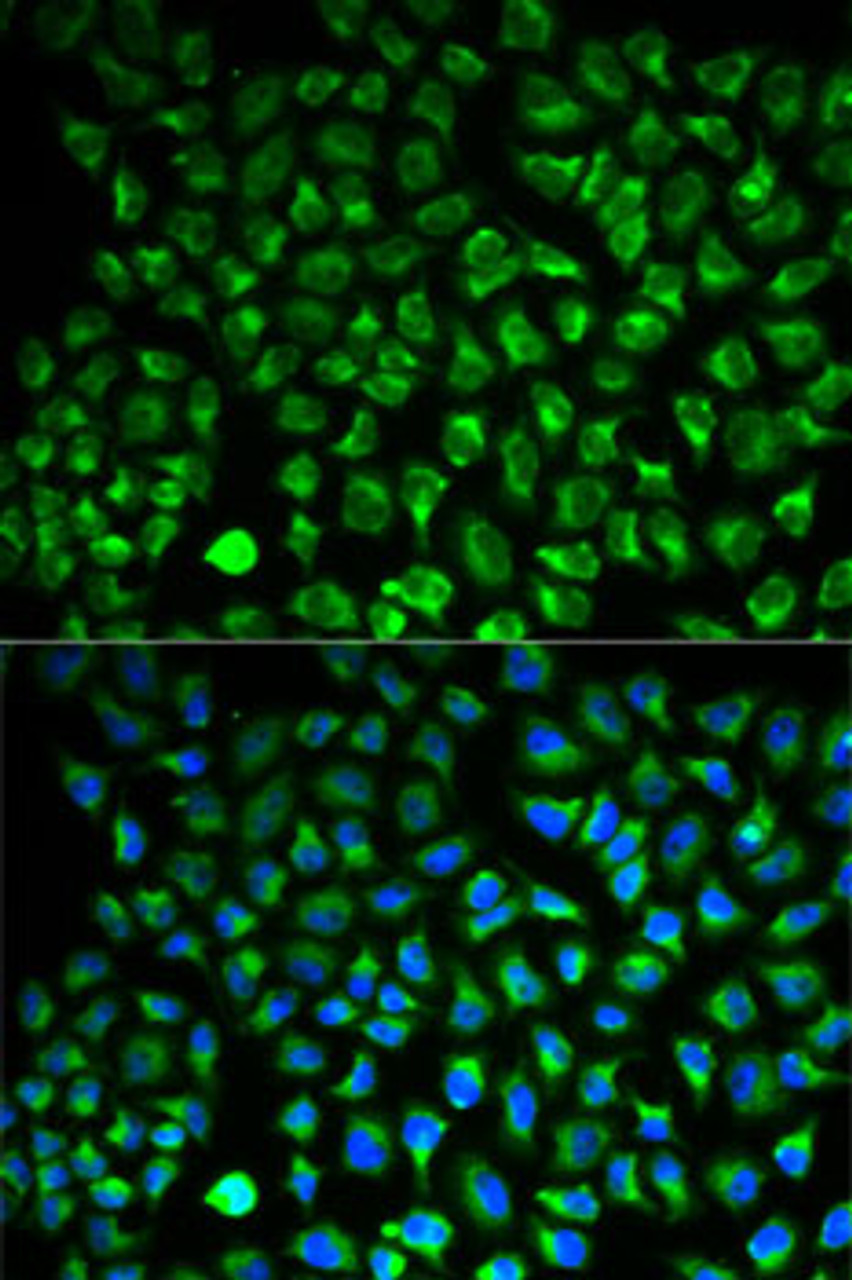 Immunofluorescence analysis of HeLa cells using MAOA antibody (15-326) . Blue: DAPI for nuclear staining.