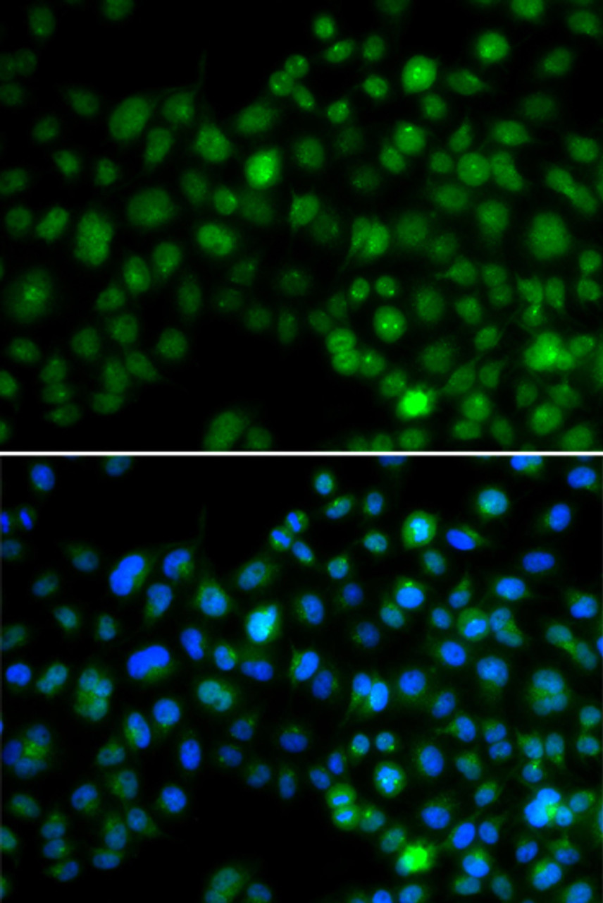 Immunofluorescence analysis of MCF-7 cells using NFIL3 antibody (15-329) . Blue: DAPI for nuclear staining.