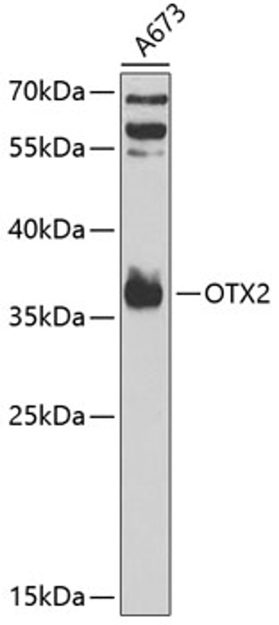 Western blot analysis of extracts of A-673 cells, using OTX2 antibody (15-334) at 1:1000 dilution.<br/>Secondary antibody: HRP Goat Anti-Rabbit IgG (H+L) at 1:10000 dilution.<br/>Lysates/proteins: 25ug per lane.<br/>Blocking buffer: 3% nonfat dry milk in TBST.<br/>Detection: ECL Basic Kit.<br/>Exposure time: 60s.