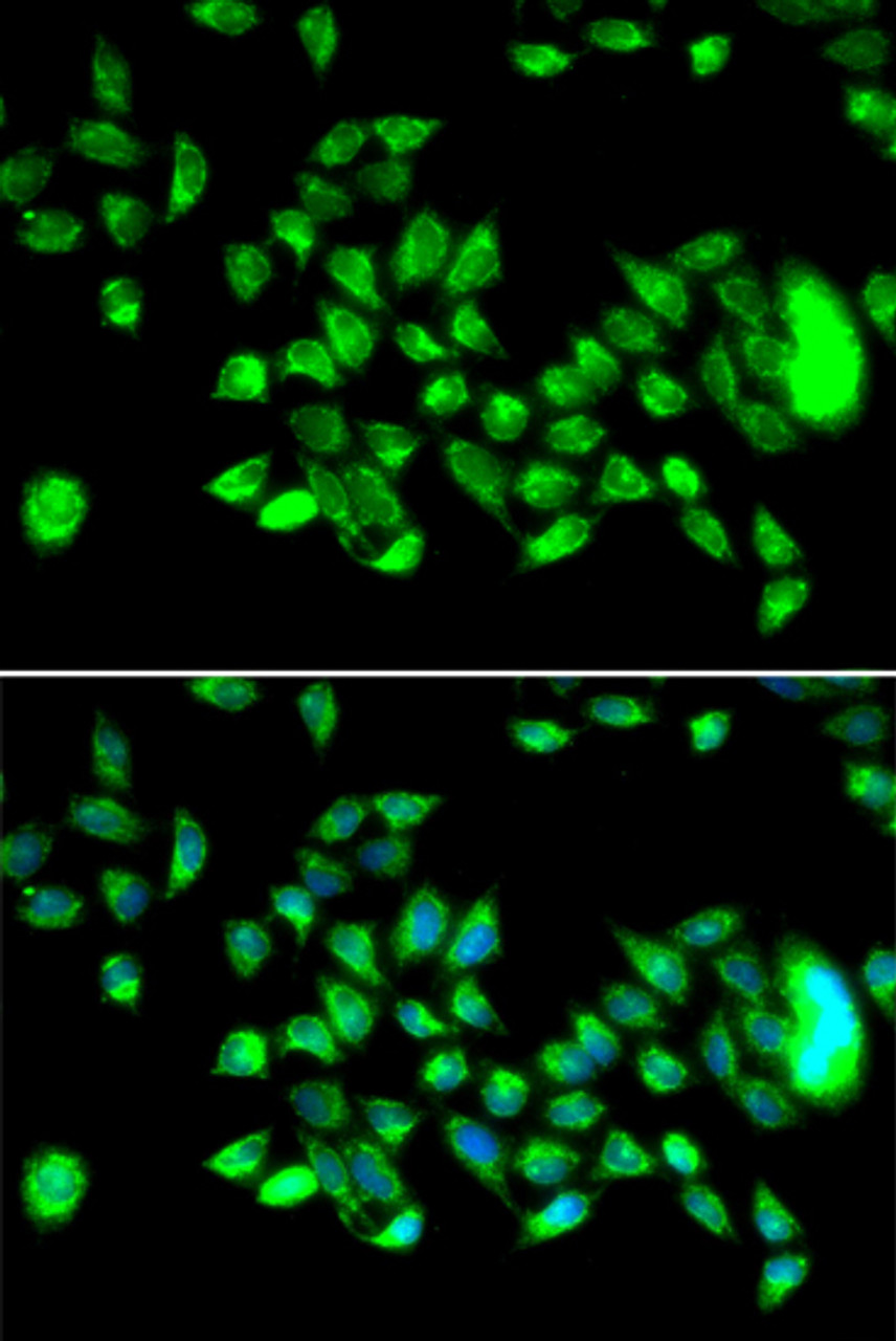 Immunofluorescence analysis of U2OS cells using HYAL3 antibody (15-358) . Blue: DAPI for nuclear staining.