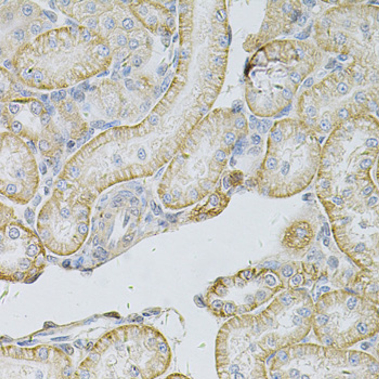 Immunohistochemistry of paraffin-embedded rat kidney using MSLN Antibody (15-369) at dilution of 1:100 (40x lens) .