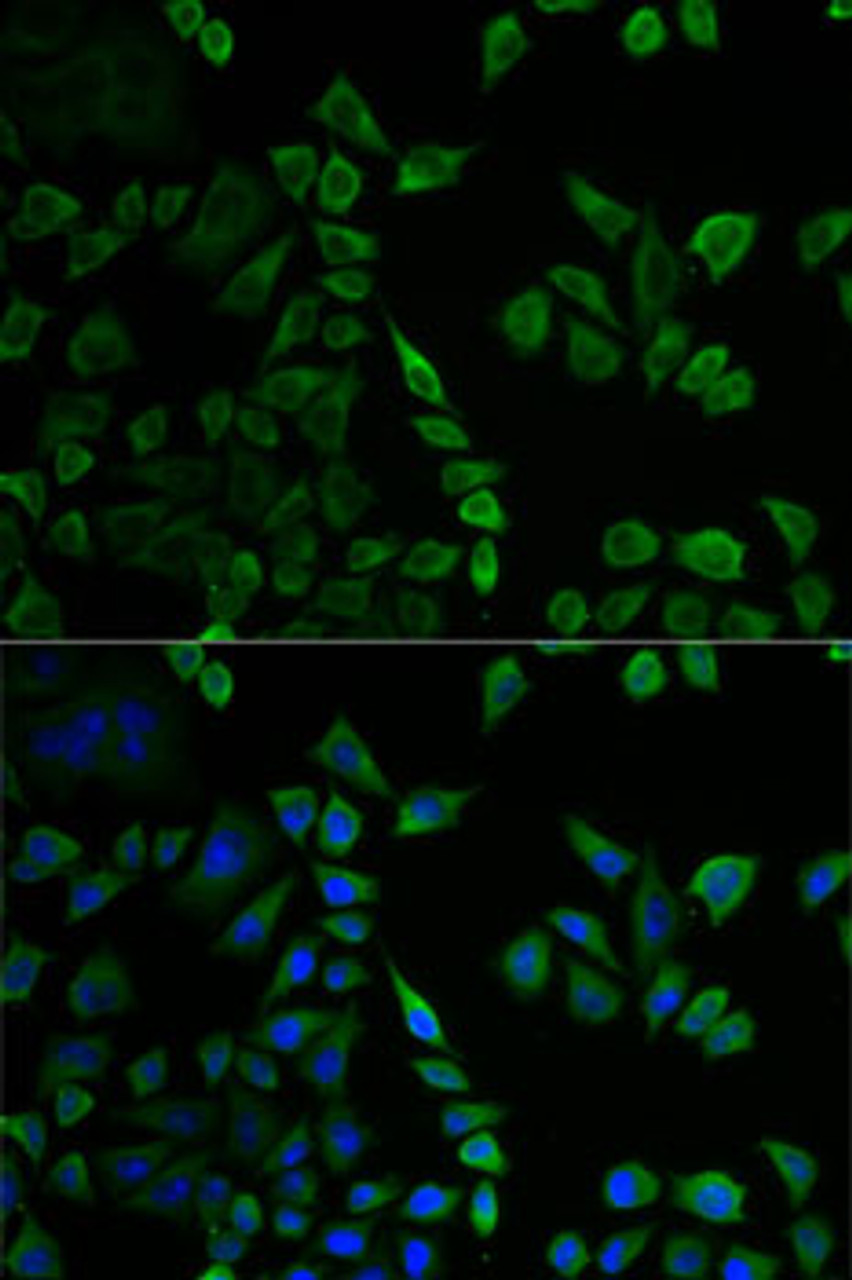 Immunofluorescence analysis of U2OS cells using MSLN antibody (15-369) . Blue: DAPI for nuclear staining.