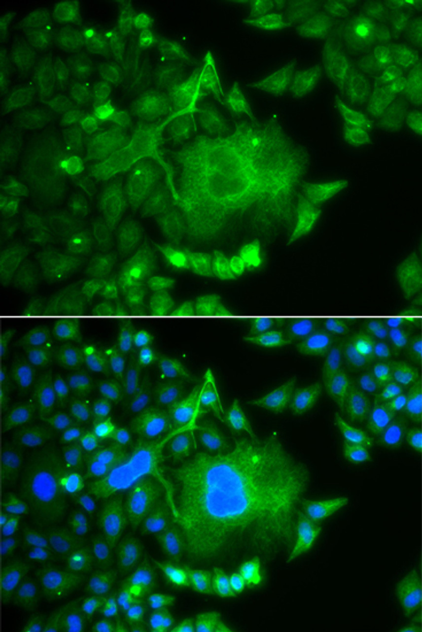 Immunofluorescence analysis of A549 cells using CACNG4 antibody (15-380) . Blue: DAPI for nuclear staining.