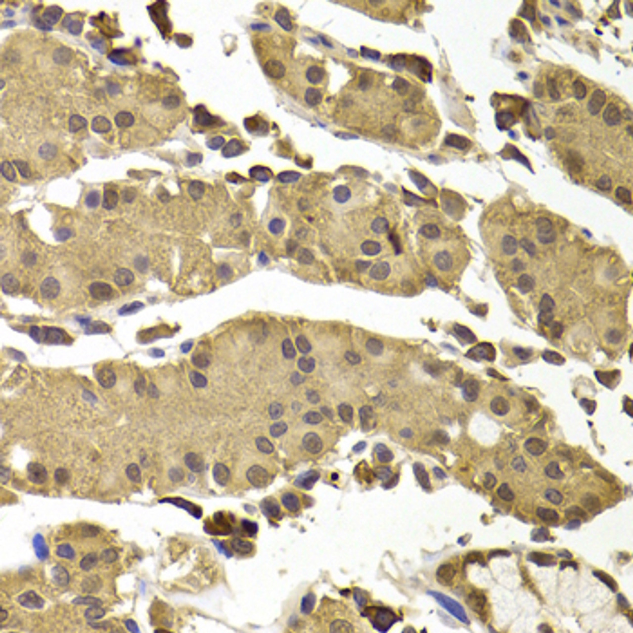 Immunohistochemistry of paraffin-embedded human stomach using SETD5 antibody (15-395) at dilution of 1:100 (40x lens) .