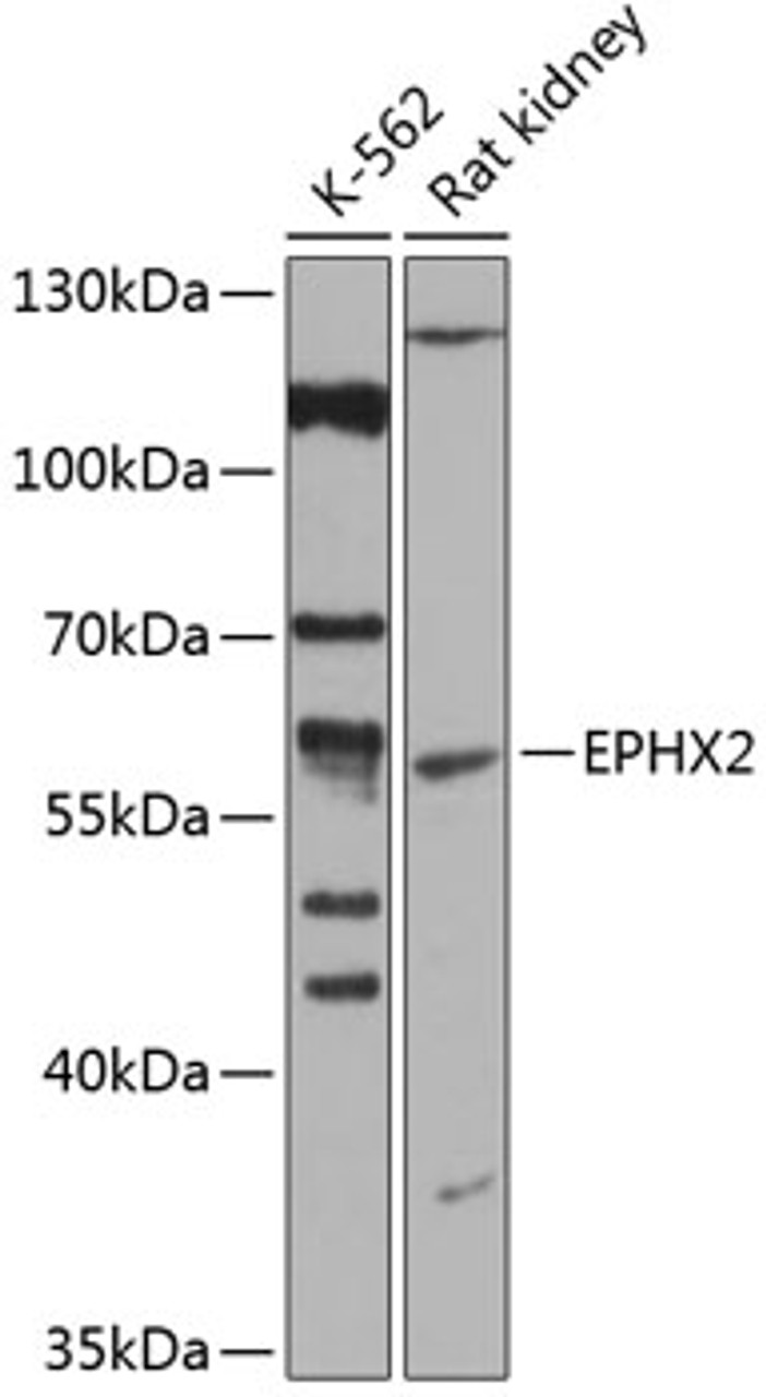 Western blot analysis of extracts of various cell lines, using EPHX2 antibody (15-424) at 1:1000 dilution.<br/>Secondary antibody: HRP Goat Anti-Rabbit IgG (H+L) at 1:10000 dilution.<br/>Lysates/proteins: 25ug per lane.<br/>Blocking buffer: 3% nonfat dry milk in TBST.<br/>Detection: ECL Enhanced Kit.<br/>Exposure time: 90s.