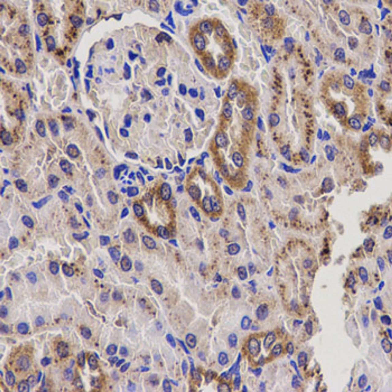 Immunohistochemistry of paraffin-embedded rat kidney using EPHX2 antibody (15-424) at dilution of 1:200 (40x lens) .