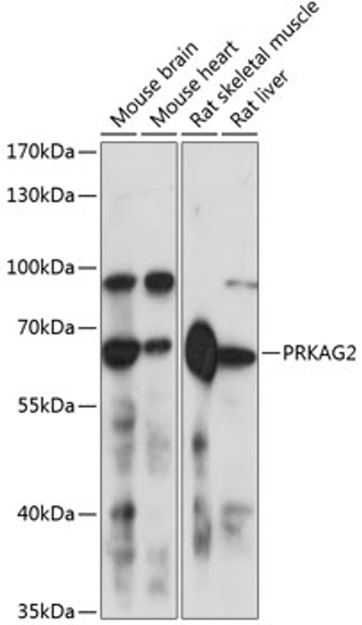 Western blot analysis of extracts of various cell lines, using PRKAG2 antibody (15-465) at 1:3000 dilution.<br/>Secondary antibody: HRP Goat Anti-Rabbit IgG (H+L) at 1:10000 dilution.<br/>Lysates/proteins: 25ug per lane.<br/>Blocking buffer: 3% nonfat dry milk in TBST.<br/>Detection: ECL Enhanced Kit.<br/>Exposure time: 1s.