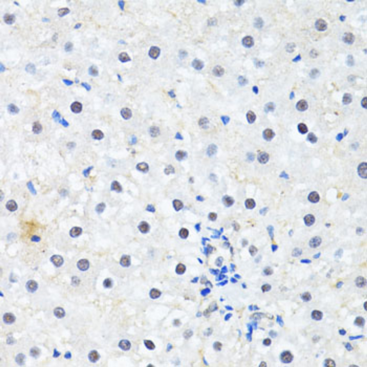 Immunohistochemistry of paraffin-embedded rat liver using PRKAG2 antibody (15-465) at dilution of 1:100 (40x lens) .