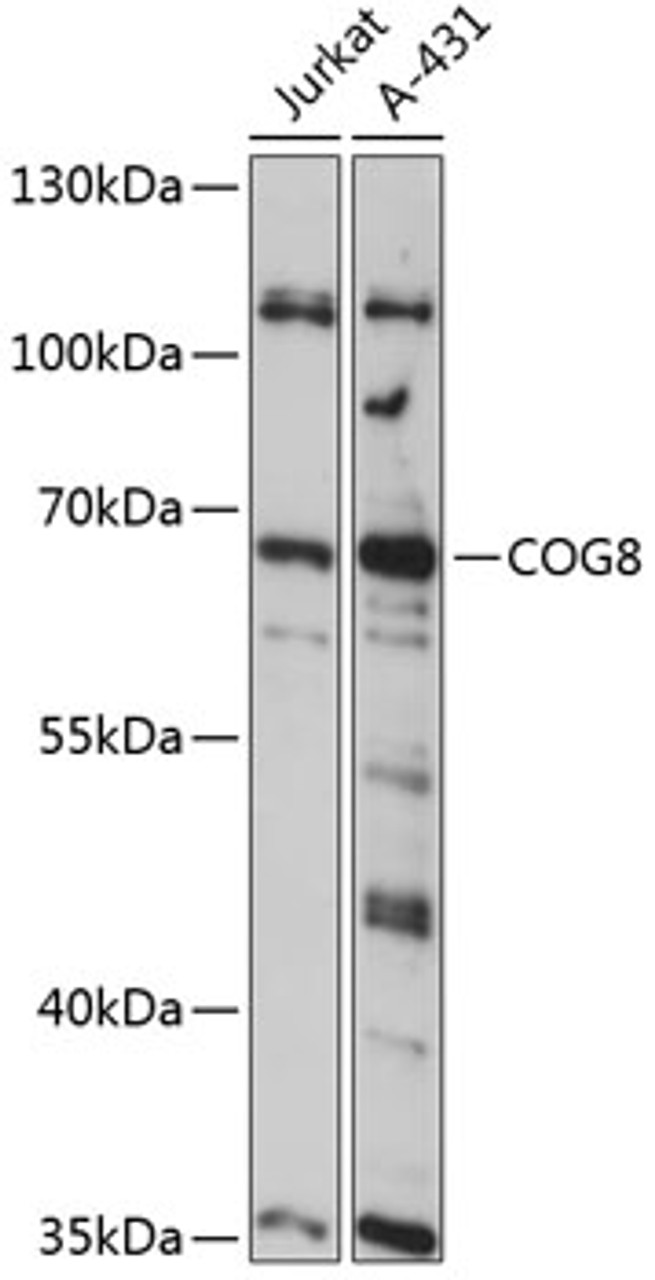 Western blot analysis of extracts of various cell lines, using COG8 antibody (15-501) at 1:3000 dilution.<br/>Secondary antibody: HRP Goat Anti-Rabbit IgG (H+L) at 1:10000 dilution.<br/>Lysates/proteins: 25ug per lane.<br/>Blocking buffer: 3% nonfat dry milk in TBST.<br/>Detection: ECL Basic Kit.<br/>Exposure time: 10s.