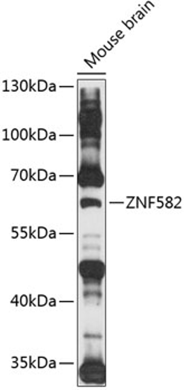 Western blot analysis of extracts of mouse brain, using ZNF582 antibody (15-551) at 1:1000 dilution.<br/>Secondary antibody: HRP Goat Anti-Rabbit IgG (H+L) at 1:10000 dilution.<br/>Lysates/proteins: 25ug per lane.<br/>Blocking buffer: 3% nonfat dry milk in TBST.<br/>Detection: ECL Basic Kit.<br/>Exposure time: 90s.