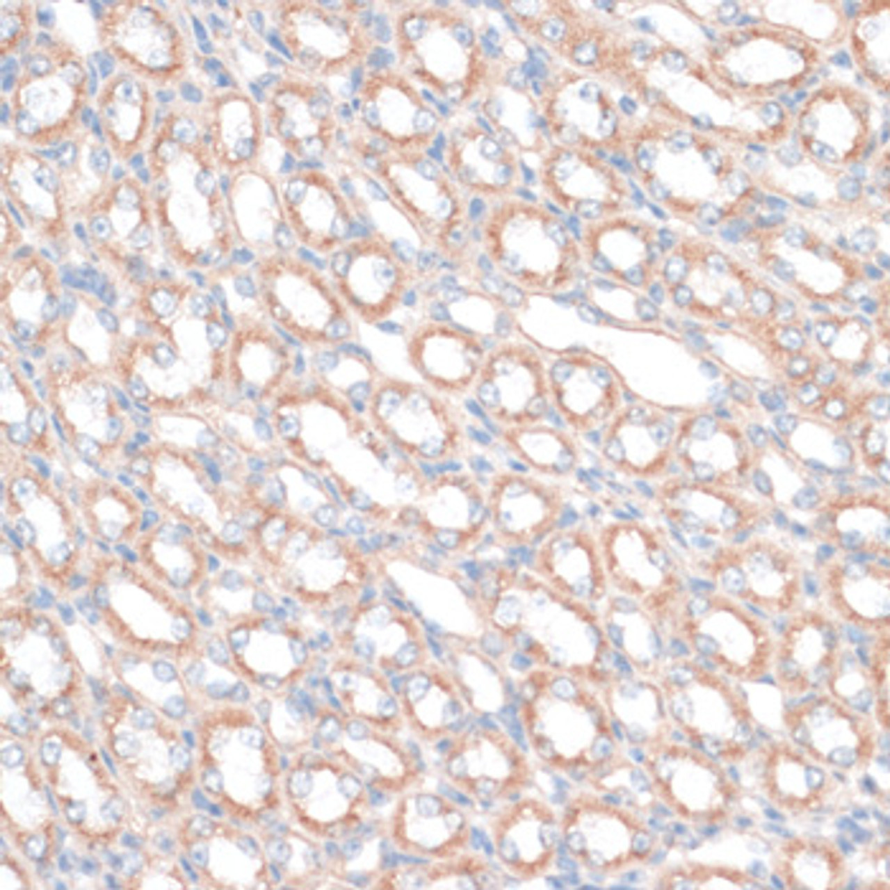 Immunohistochemistry of paraffin-embedded mouse kidney using PDGFD antibody (15-652) at dilution of 1:100 (40x lens) .