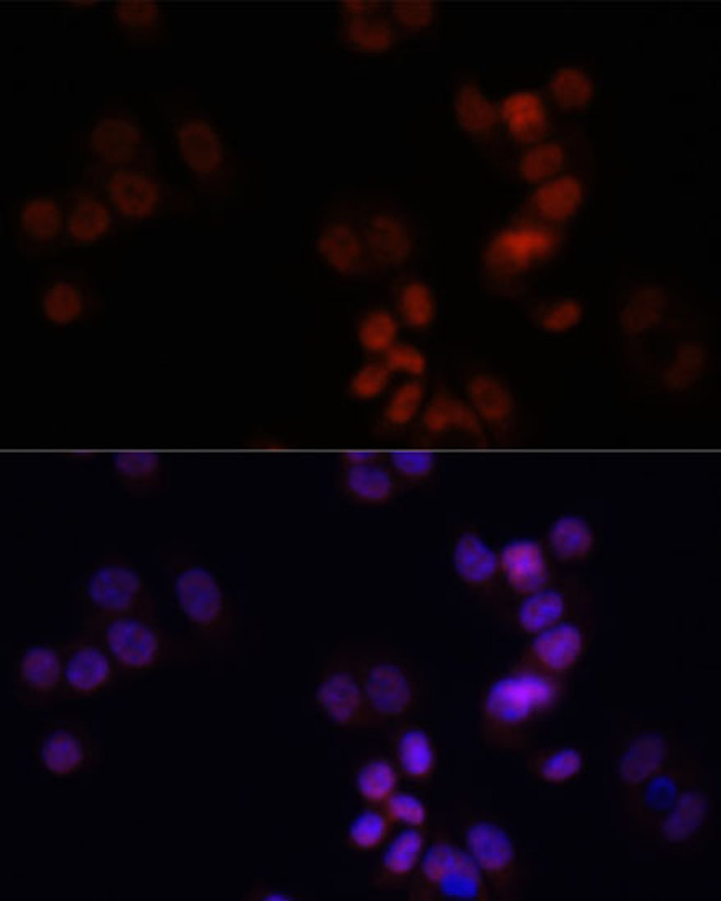 Immunofluorescence analysis of HCT116 cells using KDM7A antibody (15-667) at dilution of 1:150. Blue: DAPI for nuclear staining.