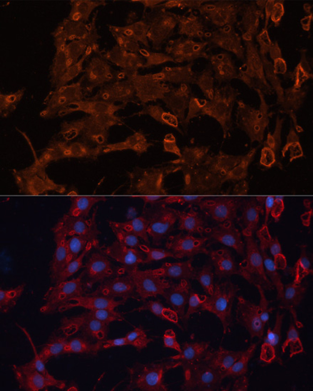 Immunofluorescence analysis of C6 cells using ABCB11 antibody (15-669) at dilution of 1:100. Blue: DAPI for nuclear staining.