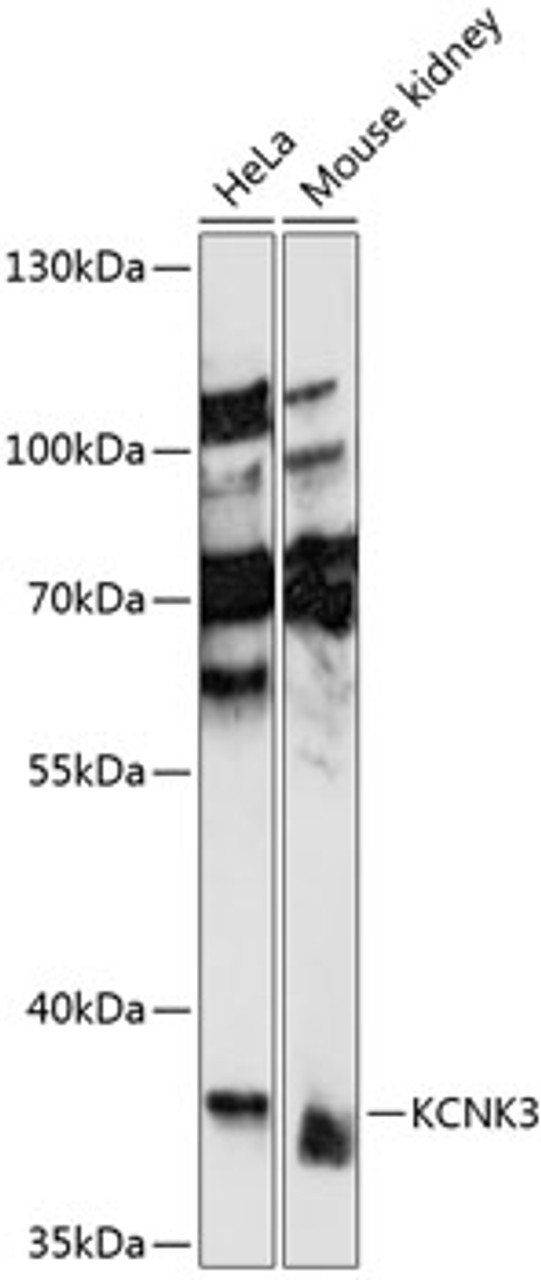 Western blot analysis of extracts of various cell lines, using KCNK3 antibody (15-701) at 1:1000 dilution.<br/>Secondary antibody: HRP Goat Anti-Rabbit IgG (H+L) at 1:10000 dilution.<br/>Lysates/proteins: 25ug per lane.<br/>Blocking buffer: 3% nonfat dry milk in TBST.<br/>Detection: ECL Basic Kit.<br/>Exposure time: 10s.