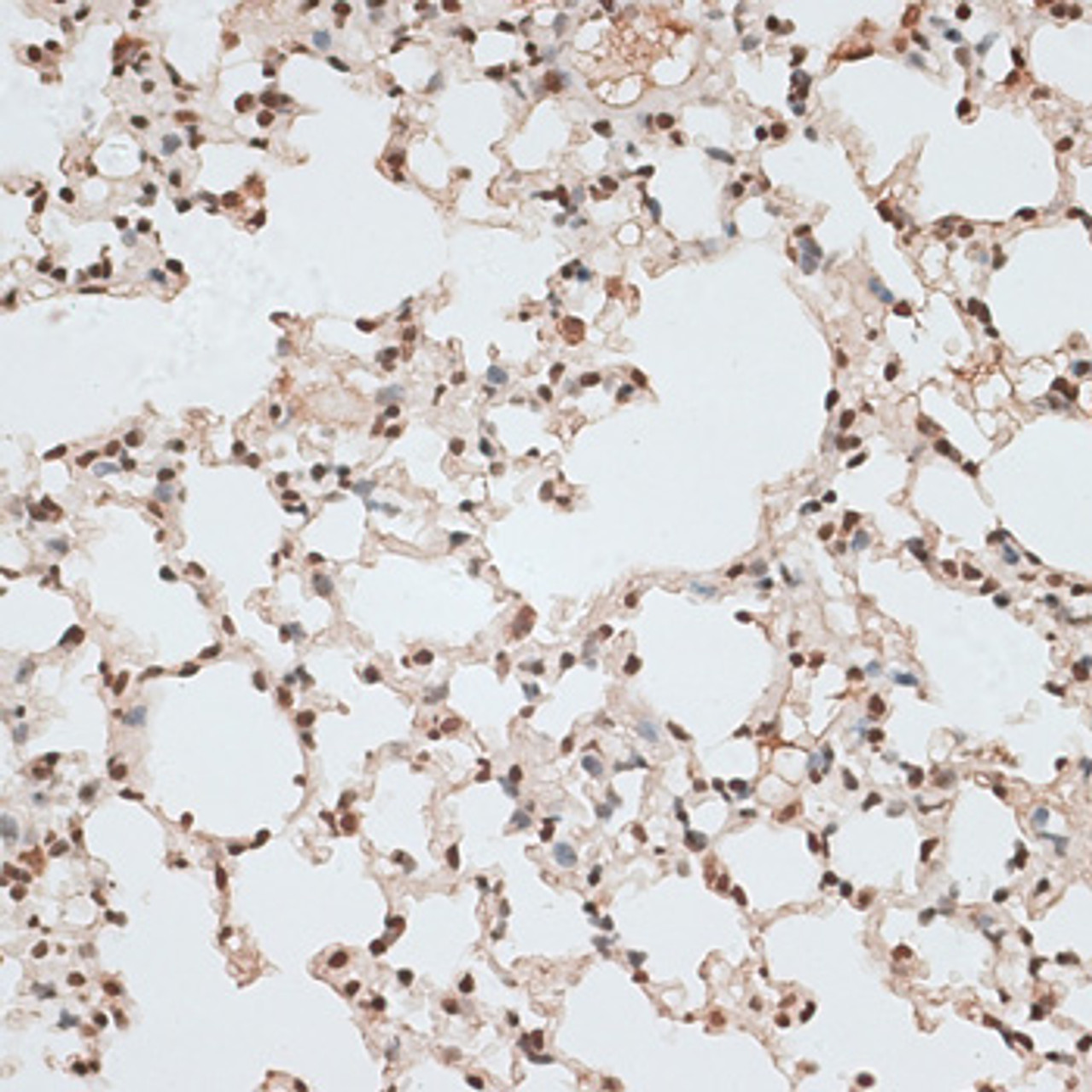 Immunohistochemistry of paraffin-embedded mouse lung using ZNF141 antibody (15-734) at dilution of 1:100 (40x lens) .