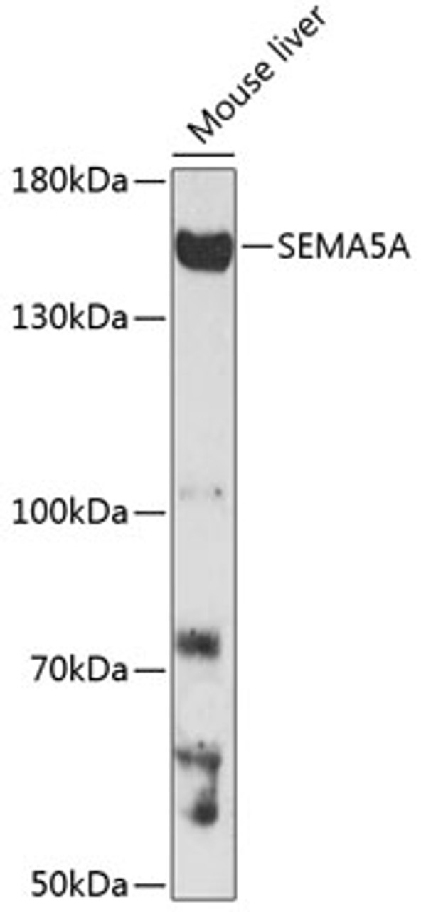 Western blot analysis of extracts of mouse liver, using SEMA5A antibody (15-744) at 1:1000 dilution.<br/>Secondary antibody: HRP Goat Anti-Rabbit IgG (H+L) at 1:10000 dilution.<br/>Lysates/proteins: 25ug per lane.<br/>Blocking buffer: 3% nonfat dry milk in TBST.<br/>Detection: ECL Enhanced Kit.<br/>Exposure time: 3min.