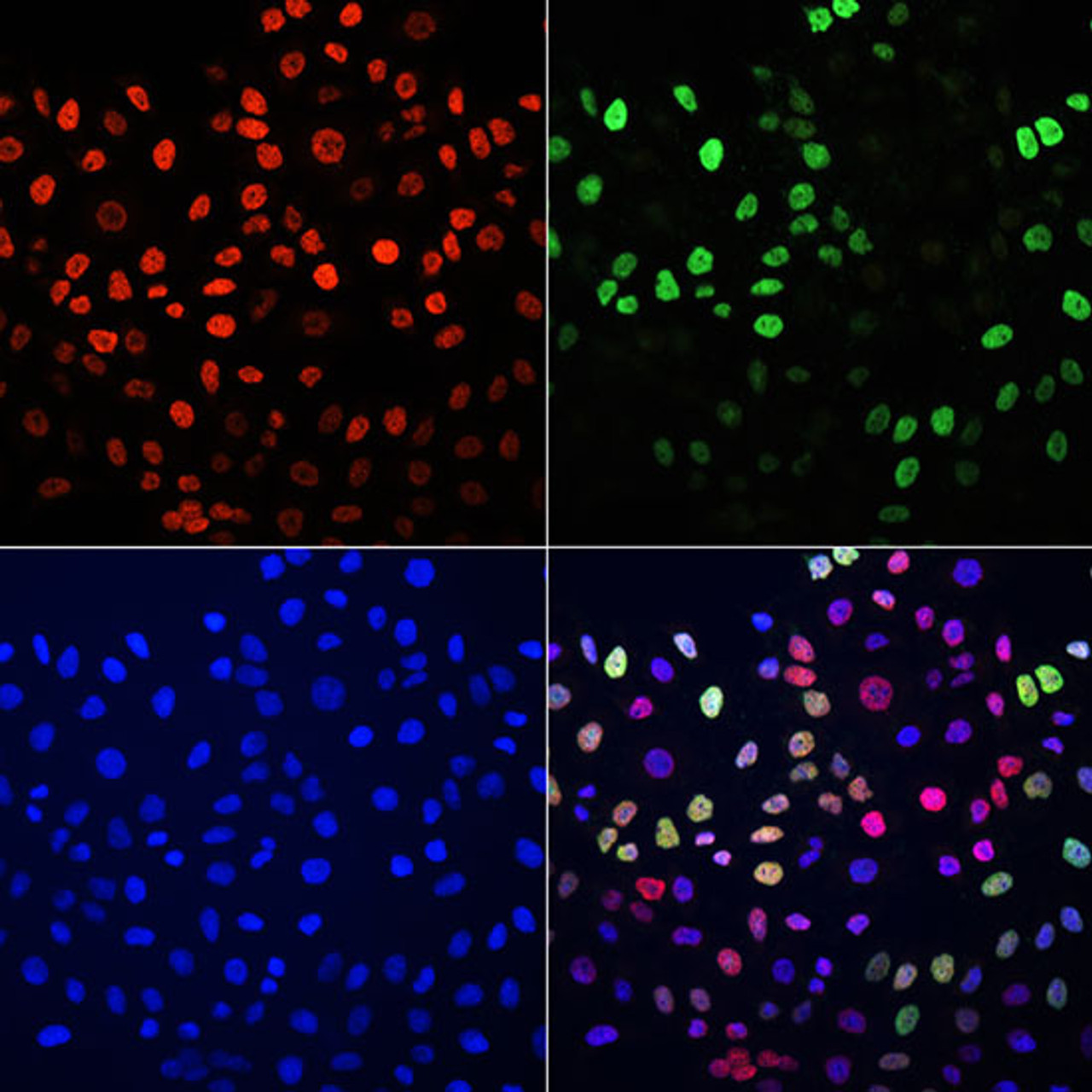 Immunofluorescence analysis of HeLa cells using BrdU antibody (Green) (15-747) and TriMethyl-Histone H3-K27 antibody (Red) (A2363) . Blue: DAPI for nuclear staining.