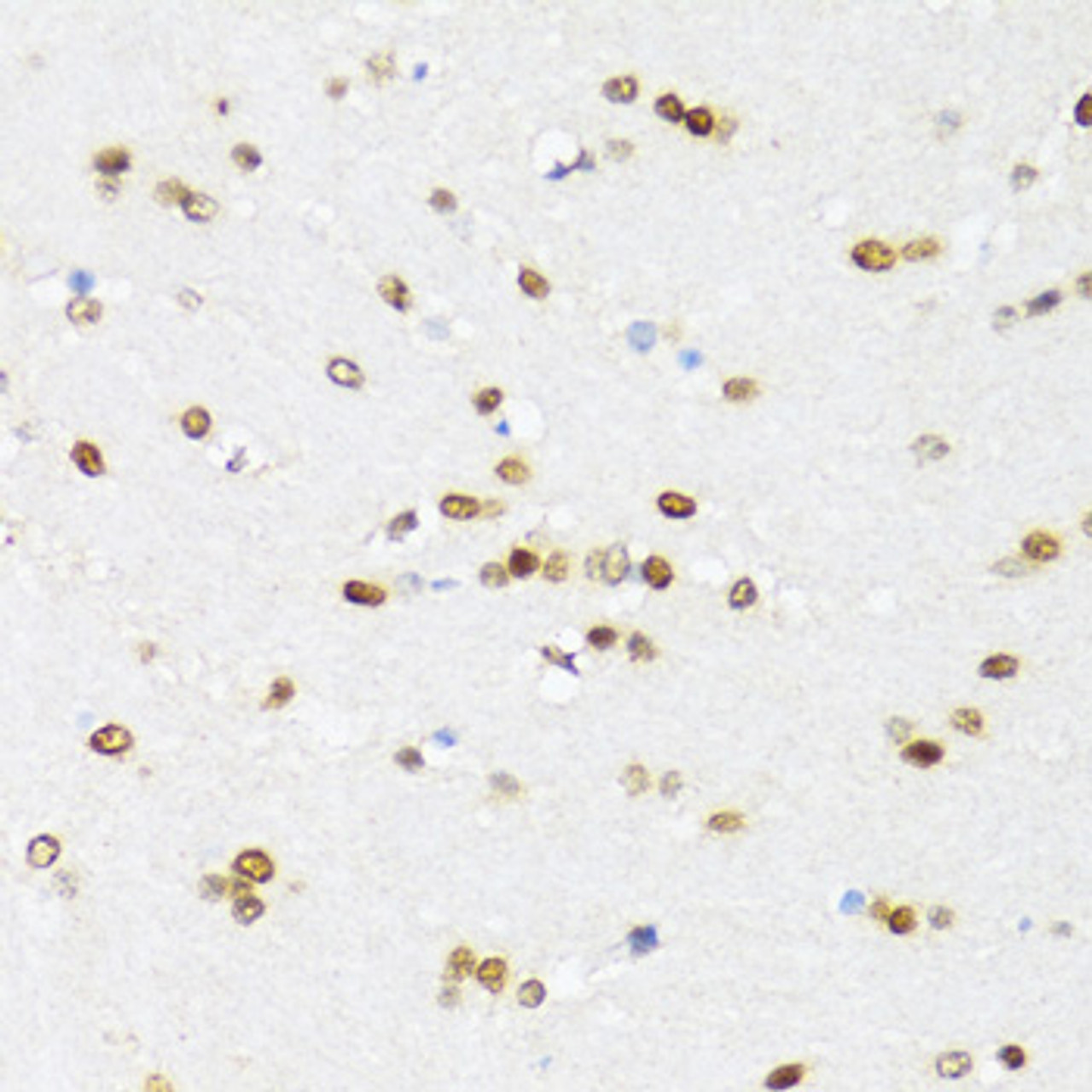 Immunohistochemistry of paraffin-embedded mouse brain using DDX21 antibody (15-748) at dilution of 1:100 (40x lens) .