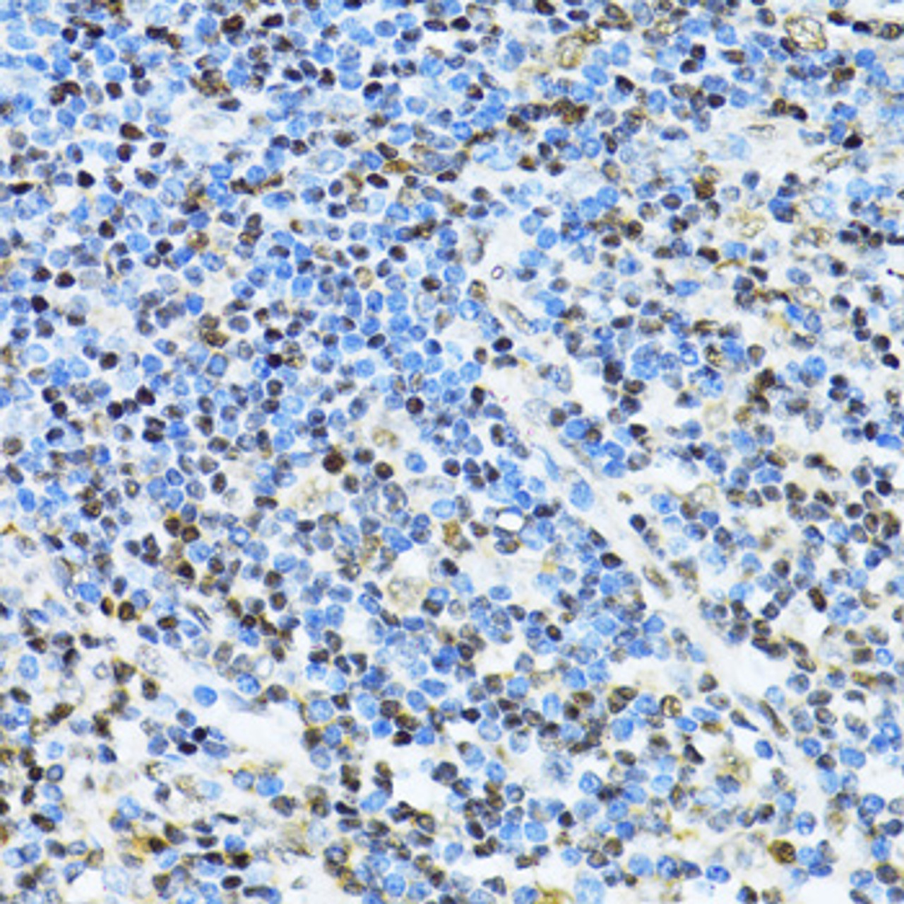 Immunohistochemistry of paraffin-embedded human appendix using ITGB3BP antibody (15-764) at dilution of 1:100 (40x lens) .