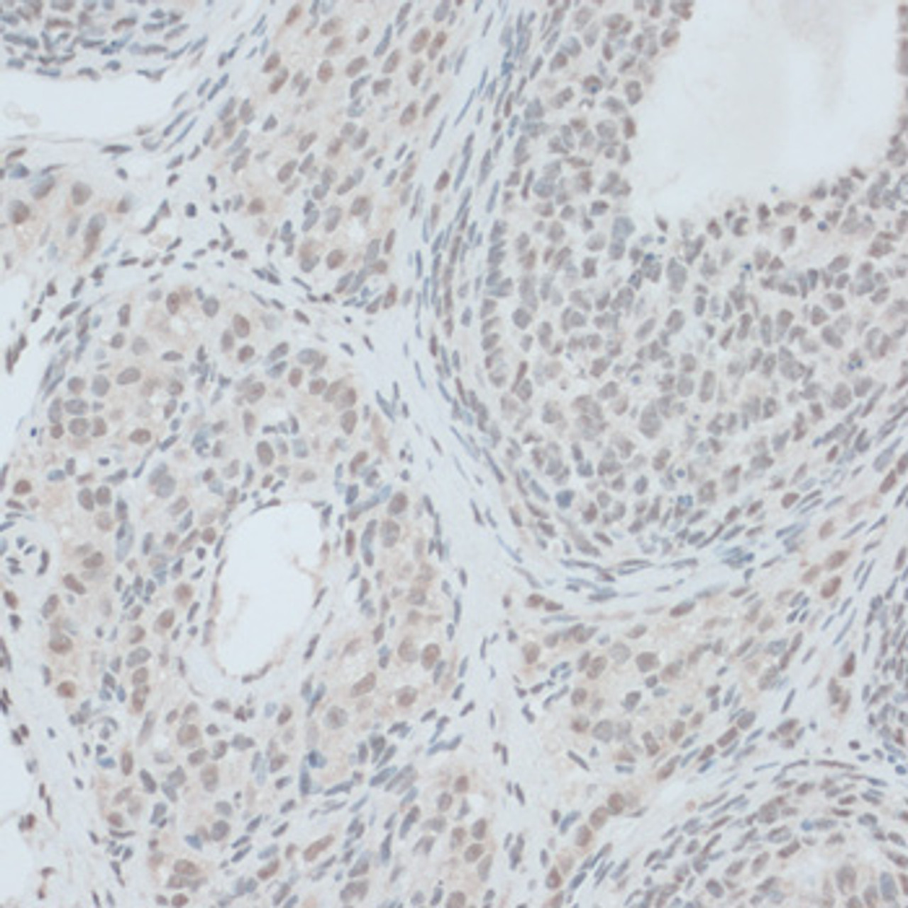 Immunohistochemistry of paraffin-embedded rat ovary using ZNF416 antibody (15-788) at dilution of 1:100 (40x lens) .