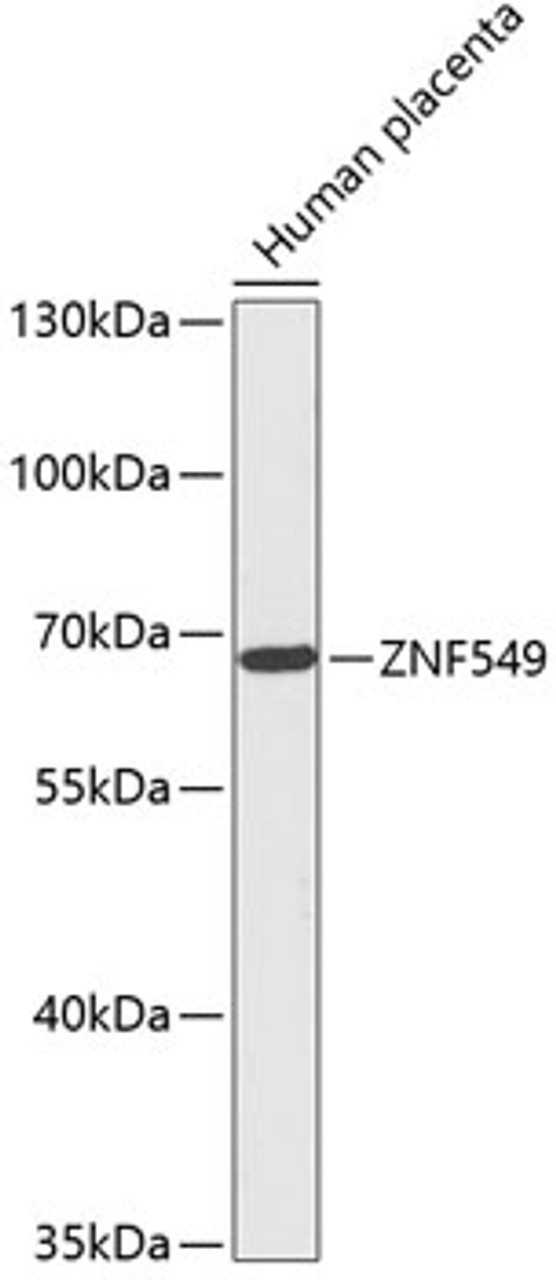 Western blot analysis of extracts of Human placenta, using ZNF549 antibody (15-815) at 1:1000 dilution.<br/>Secondary antibody: HRP Goat Anti-Rabbit IgG (H+L) at 1:10000 dilution.<br/>Lysates/proteins: 25ug per lane.<br/>Blocking buffer: 3% nonfat dry milk in TBST.<br/>Detection: ECL Basic Kit.<br/>Exposure time: 90s.
