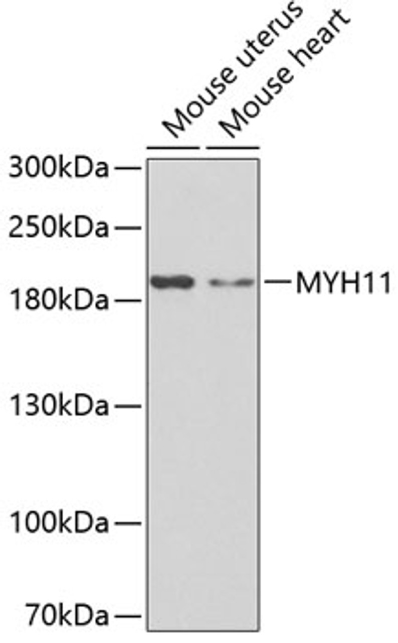Western blot analysis of extracts of various cell lines, using MYH11 antibody (15-816) .<br/>Secondary antibody: HRP Goat Anti-Rabbit IgG (H+L) at 1:10000 dilution.<br/>Lysates/proteins: 25ug per lane.<br/>Blocking buffer: 3% nonfat dry milk in TBST.