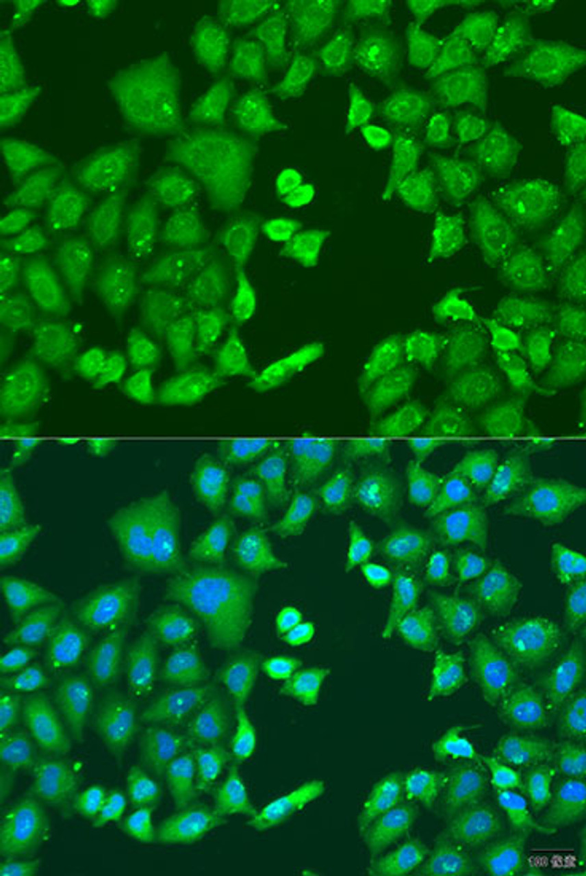 Immunofluorescence analysis of U2OS cells using CYP11B1 antibody (15-847) at dilution of 1:100. Blue: DAPI for nuclear staining.