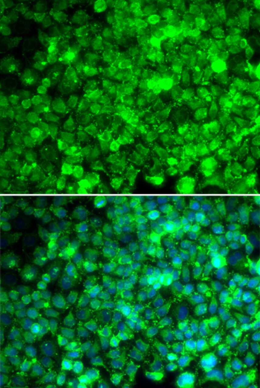 Immunofluorescence analysis of U2OS cells using Adiponectin Receptor 1 antibody (15-870) . Blue: DAPI for nuclear staining.