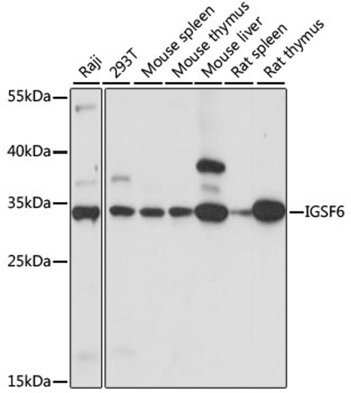 Western blot analysis of extracts of various cell lines, using IGSF6 antibody (15-891) at 1:1000 dilution.<br/>Secondary antibody: HRP Goat Anti-Rabbit IgG (H+L) at 1:10000 dilution.<br/>Lysates/proteins: 25ug per lane.<br/>Blocking buffer: 3% nonfat dry milk in TBST.<br/>Detection: ECL Basic Kit.<br/>Exposure time: 3s.