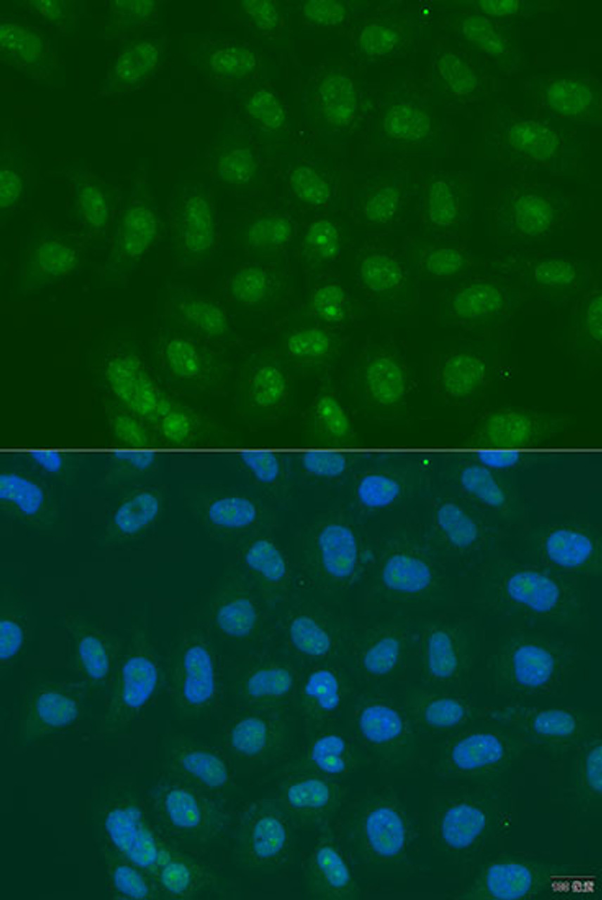 Immunofluorescence analysis of U2OS cells using LSM11 antibody (15-931) at dilution of 1:100. Blue: DAPI for nuclear staining.