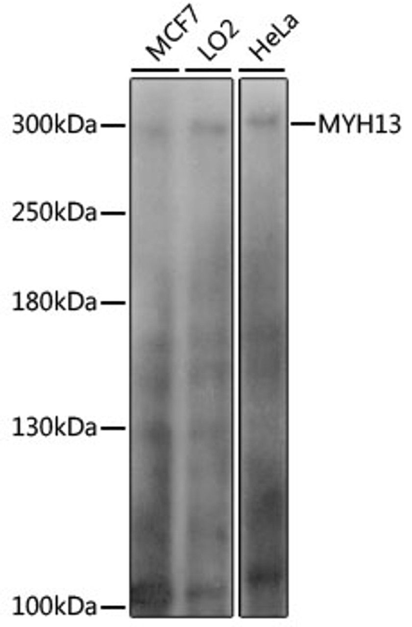 Western blot analysis of extracts of various cell lines, using MYH13 antibody (15-999) at 1:1000 dilution.<br/>Secondary antibody: HRP Goat Anti-Rabbit IgG (H+L) at 1:10000 dilution.<br/>Lysates/proteins: 25ug per lane.<br/>Blocking buffer: 3% nonfat dry milk in TBST.<br/>Detection: ECL Basic Kit.<br/>Exposure time: 20s.