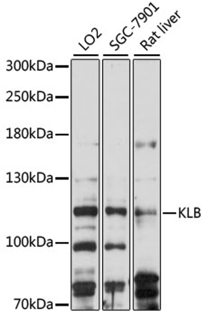 Western blot analysis of extracts of various cell lines, using KLB antibody (16-148) at 1:1000 dilution.<br/>Secondary antibody: HRP Goat Anti-Rabbit IgG (H+L) at 1:10000 dilution.<br/>Lysates/proteins: 25ug per lane.<br/>Blocking buffer: 3% nonfat dry milk in TBST.<br/>Detection: ECL Basic Kit.<br/>Exposure time: 90s.