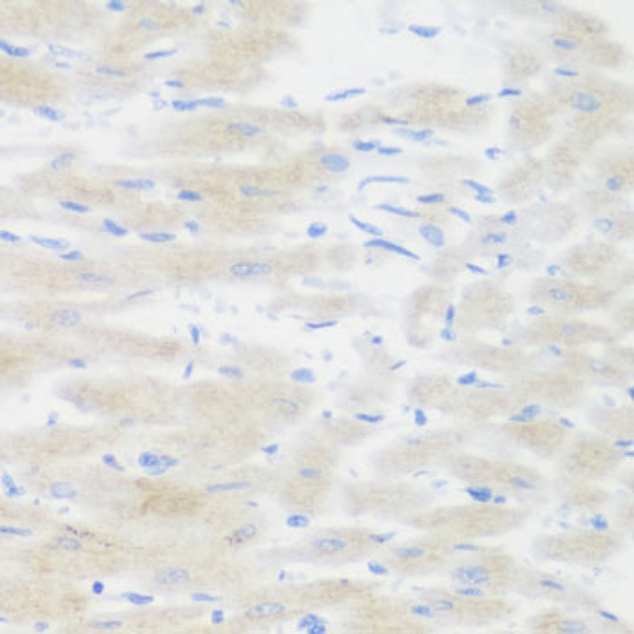 Immunohistochemistry of paraffin-embedded rat heart using BMP2 antibody (16-158) at dilution of 1:100 (40x lens) .