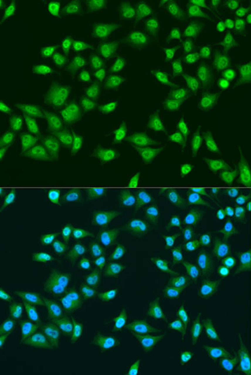 Immunofluorescence analysis of U2OS cells using RPS6KB1 antibody (16-196) at dilution of 1:100. Blue: DAPI for nuclear staining.