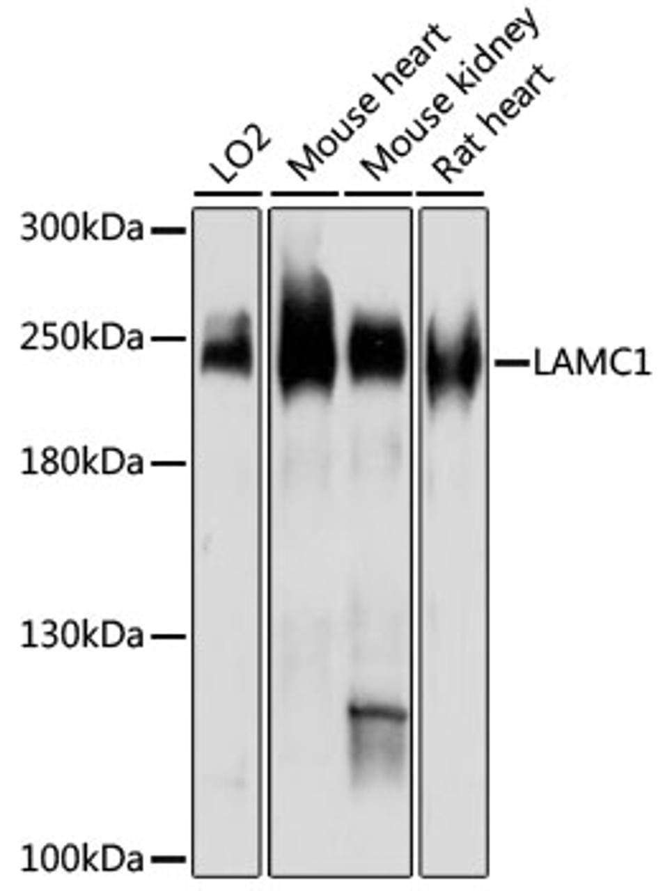 Western blot analysis of extracts of various cell lines, using LAMC1 antibody (16-379) at 1:3000 dilution.<br/>Secondary antibody: HRP Goat Anti-Rabbit IgG (H+L) at 1:10000 dilution.<br/>Lysates/proteins: 25ug per lane.<br/>Blocking buffer: 3% nonfat dry milk in TBST.<br/>Detection: ECL Enhanced Kit.<br/>Exposure time: 30s.