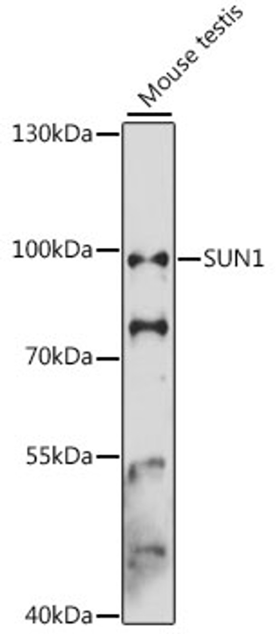 Western blot analysis of extracts of mouse testis, using SUN1 antibody (16-382) at 1:3000 dilution.<br/>Secondary antibody: HRP Goat Anti-Rabbit IgG (H+L) at 1:10000 dilution.<br/>Lysates/proteins: 25ug per lane.<br/>Blocking buffer: 3% nonfat dry milk in TBST.<br/>Detection: ECL Basic Kit.<br/>Exposure time: 30s.