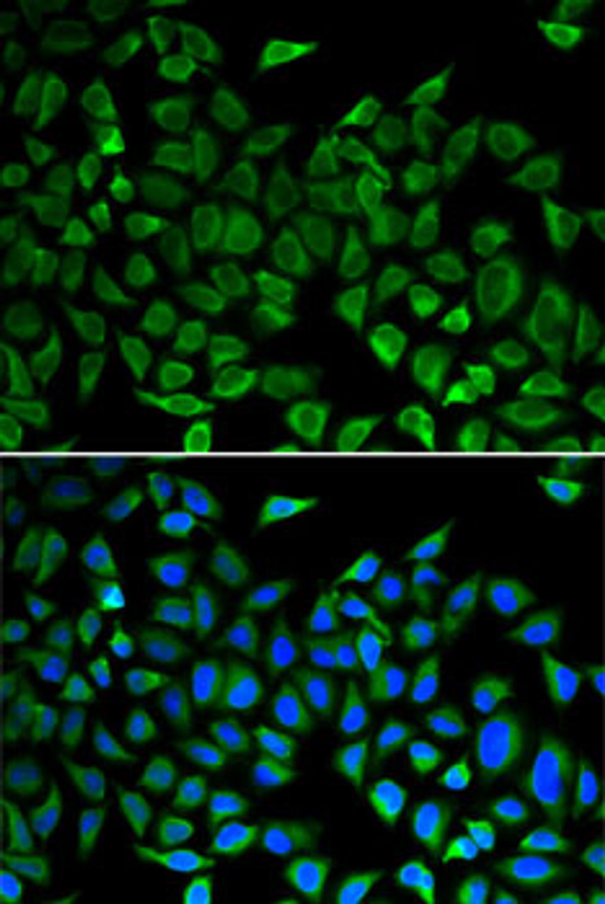 Immunofluorescence analysis of A-549 cells using cdc45 antibody (16-386) . Blue: DAPI for nuclear staining.