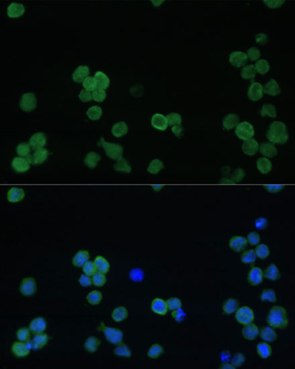 Immunofluorescence analysis of THP-1 cells using GP1BA Polyclonal Antibody (16-397) at dilution of 1:100 (40x lens) . Blue: DAPI for nuclear staining.