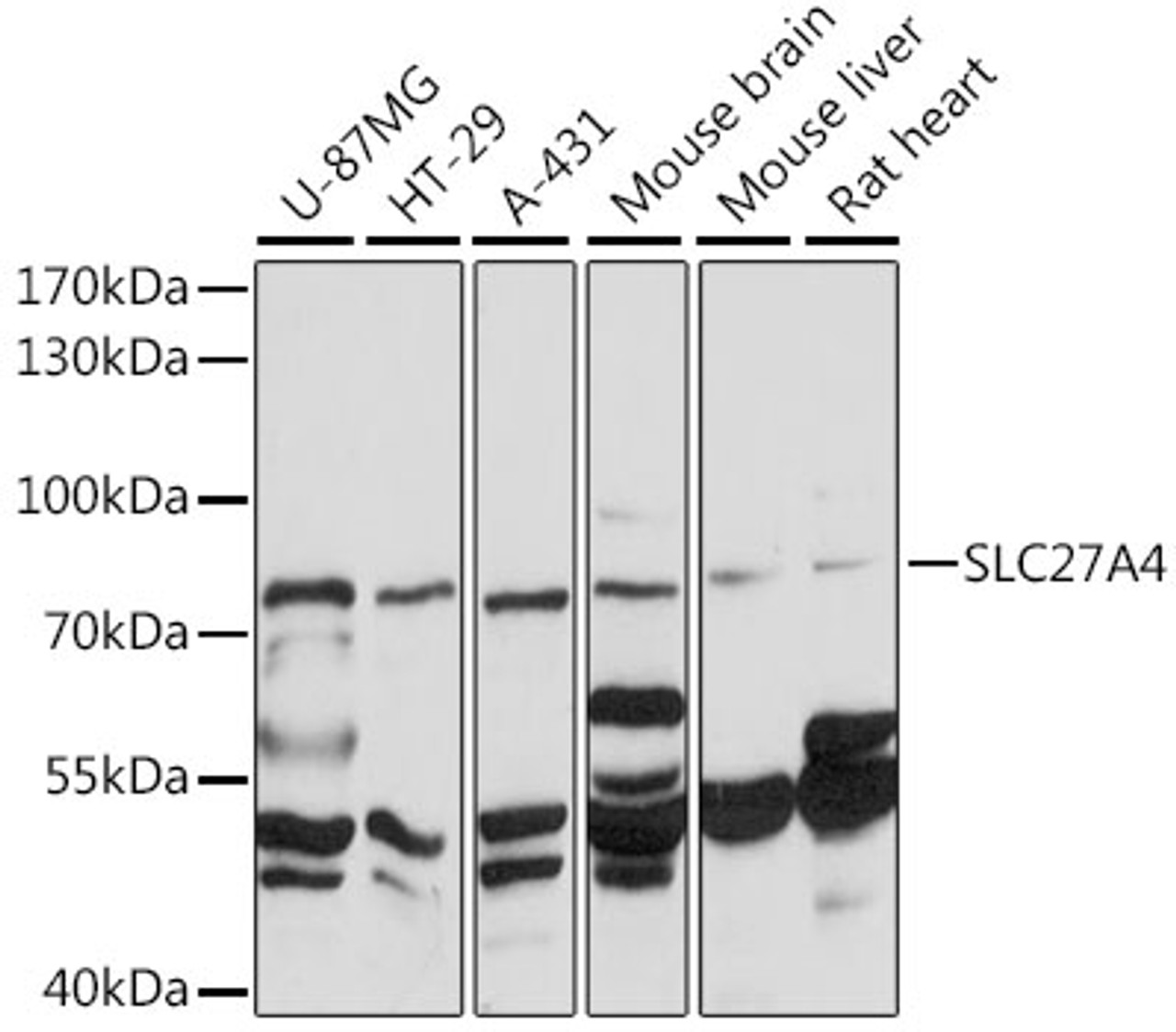 Western blot analysis of extracts of various cell lines, using SLC27A4 antibody (16-430) at 1:1000 dilution.<br/>Secondary antibody: HRP Goat Anti-Rabbit IgG (H+L) at 1:10000 dilution.<br/>Lysates/proteins: 25ug per lane.<br/>Blocking buffer: 3% nonfat dry milk in TBST.<br/>Detection: ECL Basic Kit.<br/>Exposure time: 30s.